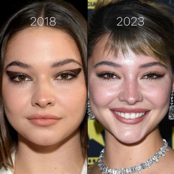 Madelyn Cline Chirurgie